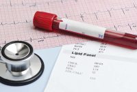 How To Maintain Healthy Cholesterol Levels Effectively