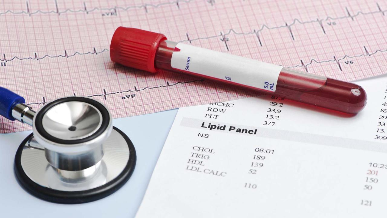 10 Natural Ways to Lower Your Cholesterol Levels - HEALTHCOPEIA How To Maintain Healthy Cholesterol Levels