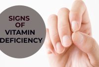 What Are The Signs Of Vitamin Deficiency In Adults