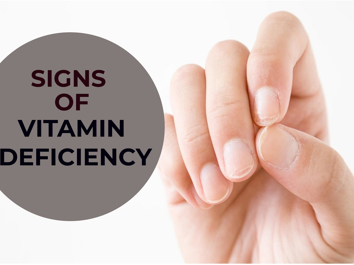 What Are The Signs Of Vitamin Deficiency In Adults